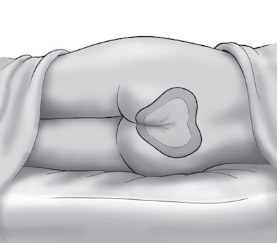 ECLYPSE SACRAL - USO1